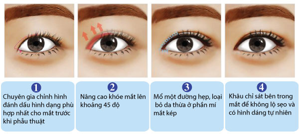 5 phương pháp thẩm mỹ mắt đẹp phụ nữ tuổi 30 nên biết 4